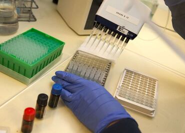 UNAM scientists identify existing drug for hepatitis C that might treat COVID-19