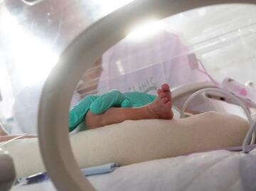 Bebé que recuperó signos vitales en su funeral, muere una semana después en Paraguay