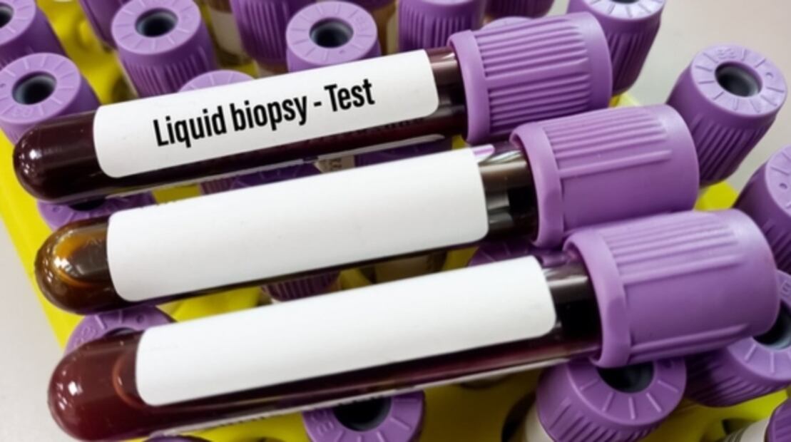 Cuatro novedades en los tratamientos contra el cáncer