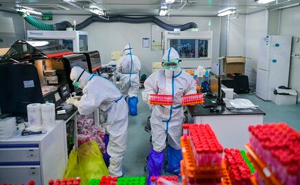 Vacuna contra Covid-19: ¿En qué se diferencian las Oxford, Pfizer y Moderna?