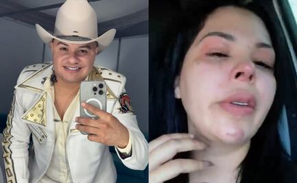 Los Recoditos: ¿quién es Rafa González, vocalista de la banda que fue denunciado por su esposa de maltrato?	