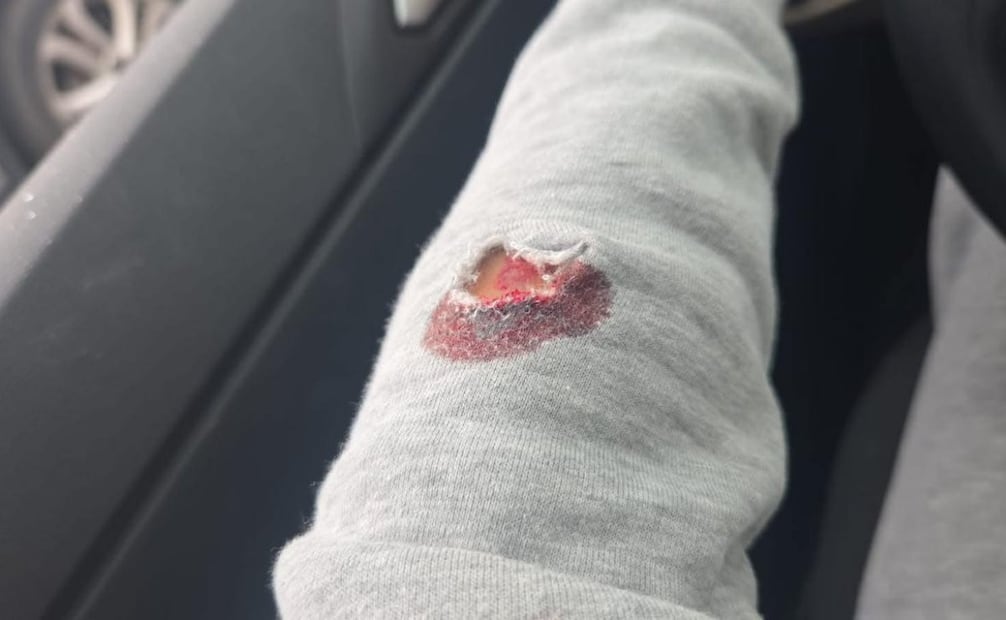 Tania “N”, funcionaria del actual gobierno municipal de Tecámac, fue herida de bala (31/12/2025). Foto: Especial