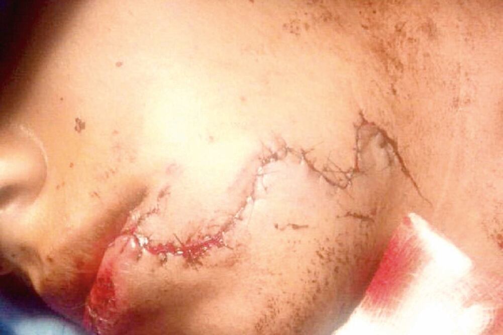El hijo del dueño del bar salió tras su padre al ver que se alejaba del negocio; sufrió cortes profundos en cara y cuello (ESPECIAL)