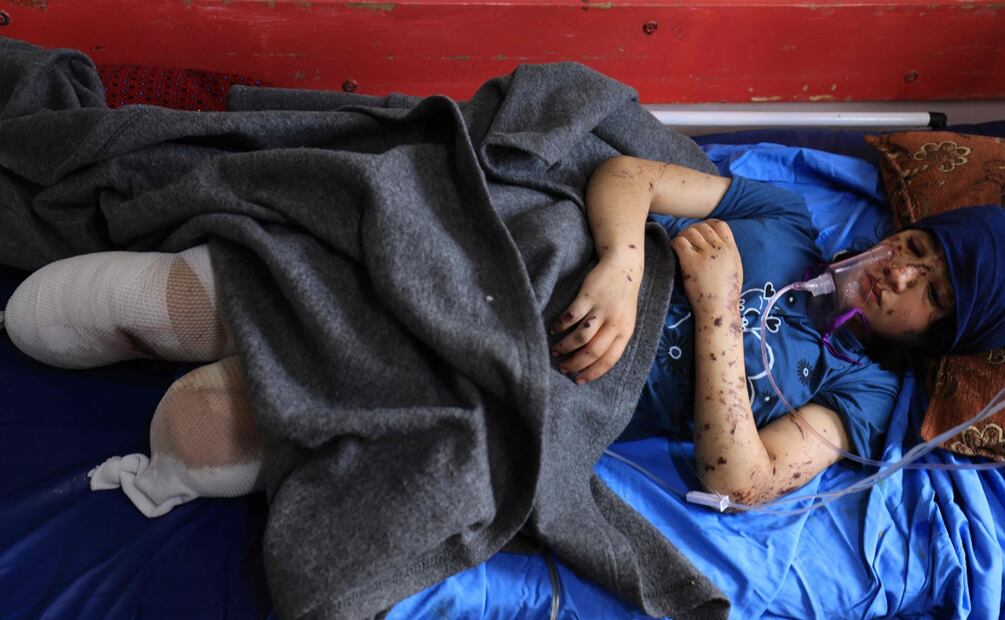 Layan resultó débilmente herido en un ataque en el distrito de Al-Qarara, como parte de la campaña militar de Israel en respuesta a los sangrientos ataques de Hamas. Foto: AFP