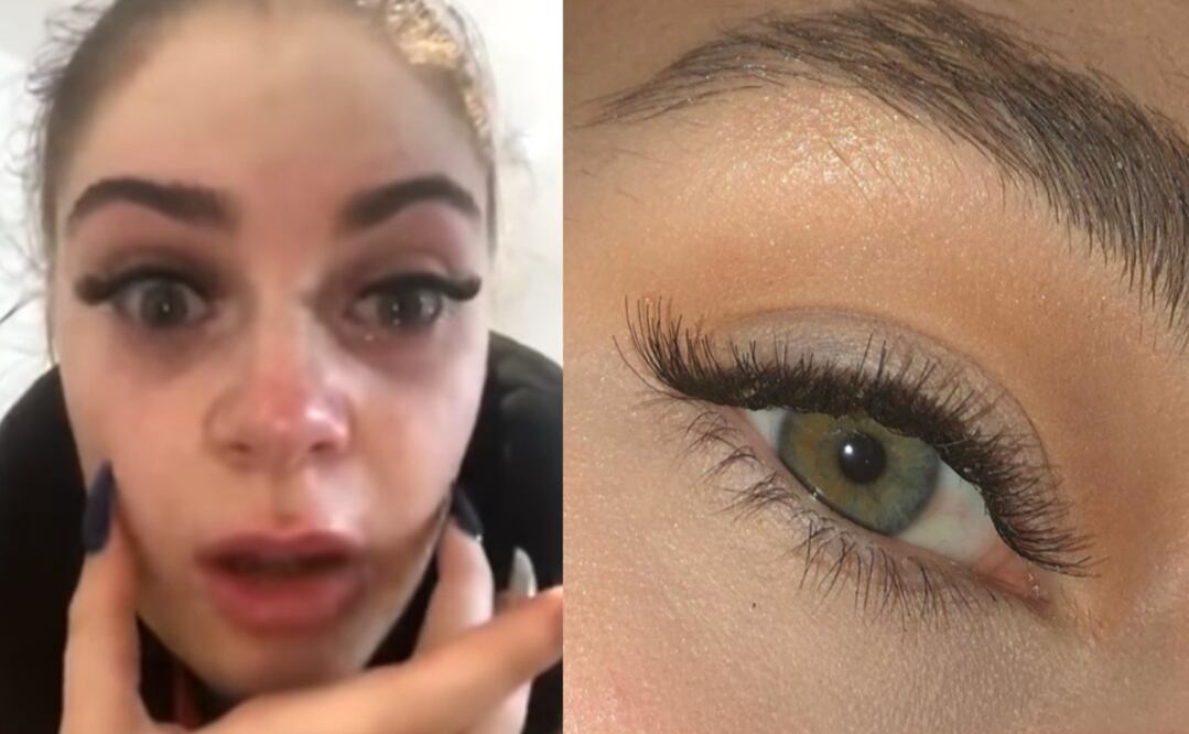 Megan Rickson no imaginó que un tratamiento mal aplicado le haría pasar el peor susto de su vida. Foto: Captura de pantalla / Instagram