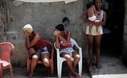 OMS: aumentan evidencias que apunta a vínculo del zika con microcefalia