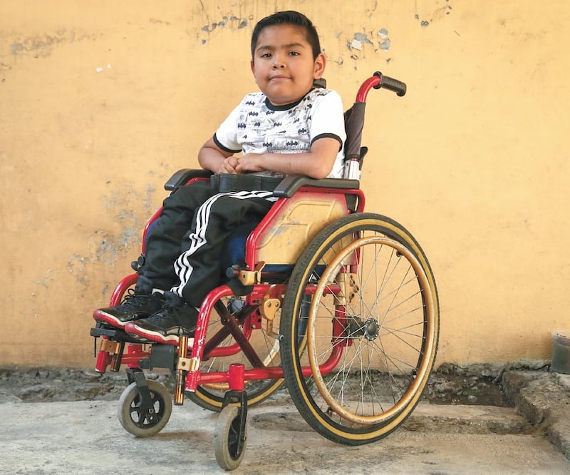 Con casi seis años de edad, Axel continúa asistiendo regularmente a la escuela porque aún no ha presentado problemas de carácter lingüístico a causa de la atrofia muscular. Fotos: DIEGO SIMÓN/EL UNIVERSAL