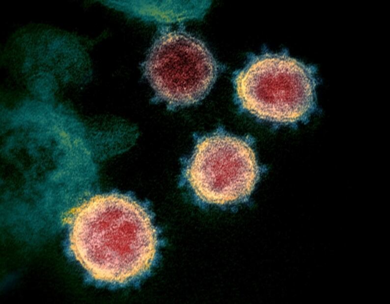Mutación del coronavirus aumenta carga viral en vías respiratorias: estudio