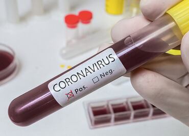 Several Mexican Governors have contracted COVID-19