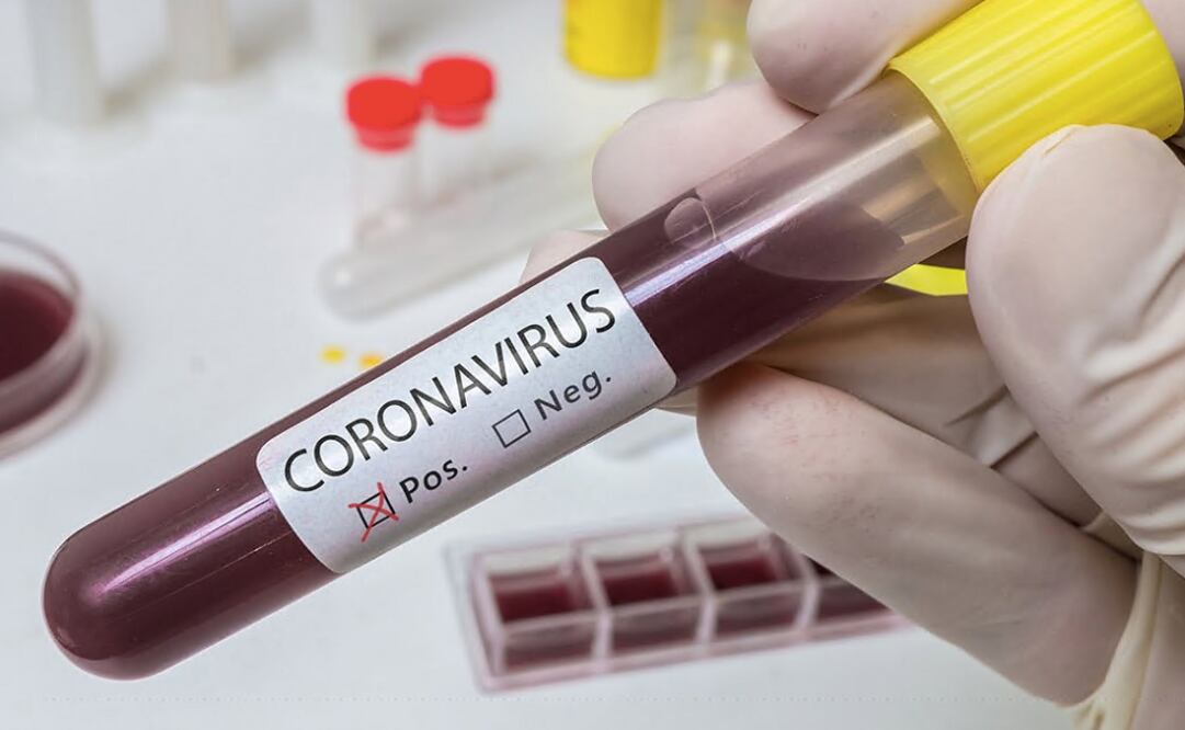 Several politicians and at least three Mexican Governors have been diagnosed with COVID-19 - Photo: Feature Photo