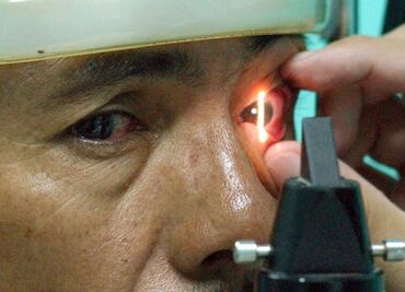 Glaucoma puede provocar pérdida total y permanente de la vista