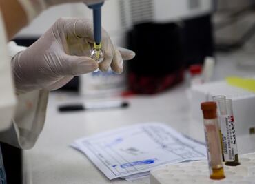 Brote de zika terminaría en dos o tres años: estudio