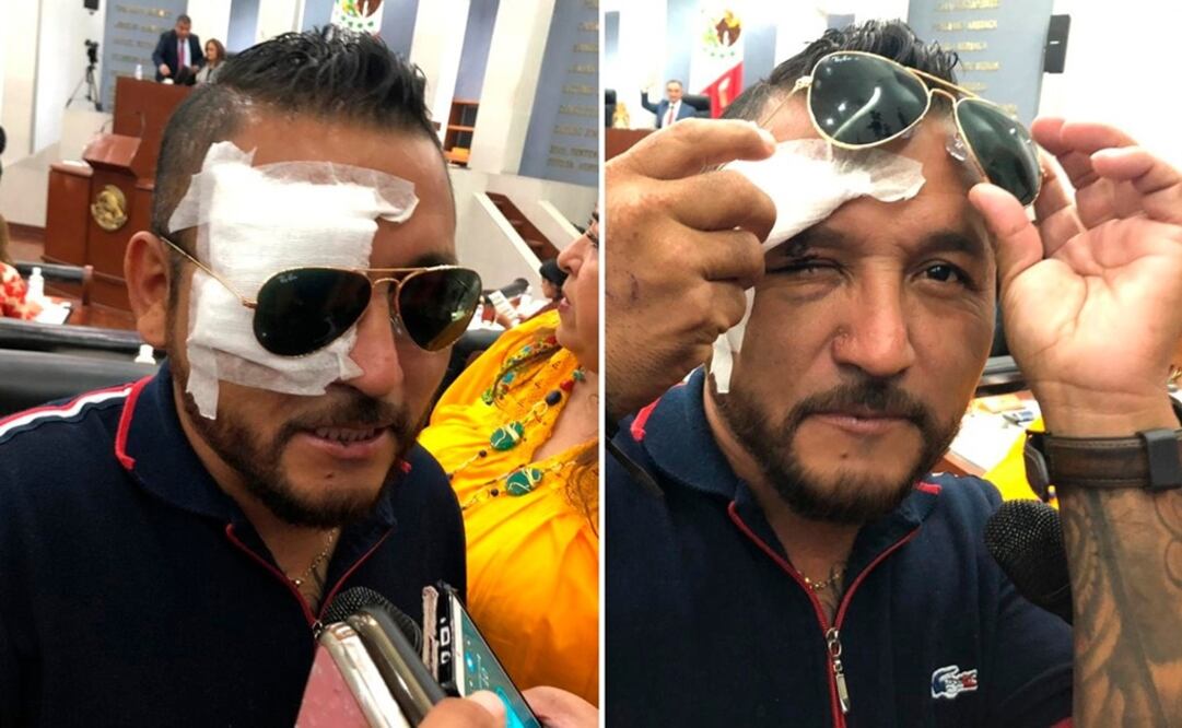 Fotos: EL UNIVERSAL San Luis Potosí