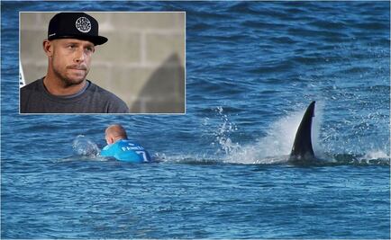 Surfista atacado por tiburón: "Fue un milagro" 