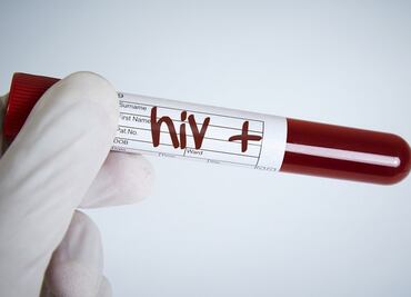 VIH/Sida: Los países de Latinoamérica con mayor aumento de nuevos contagios