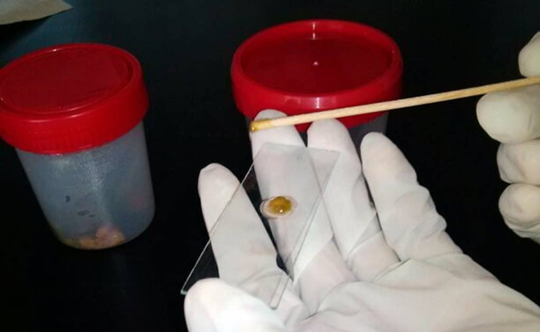 (Foto: Tomada de coproparasitoscopico.com)
