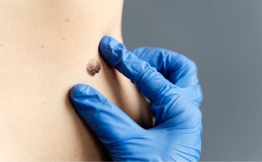 Kalanchoe y salud. Fuente: Freepik