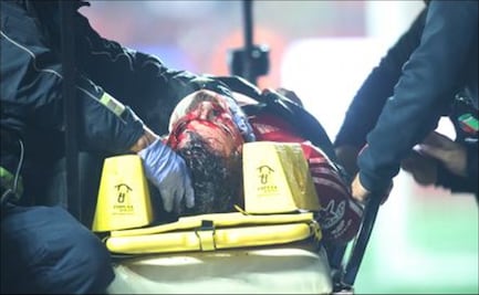 Aficionado de Xolos que se accidentó sigue grave