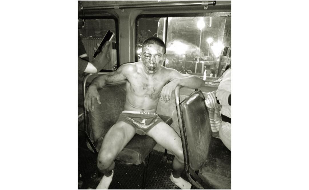 Al lugar arribaron elementos de la Policía Auxiliar, quienes detuvieron al sujeto luego de proporcionarle atención médica Foto: Especial