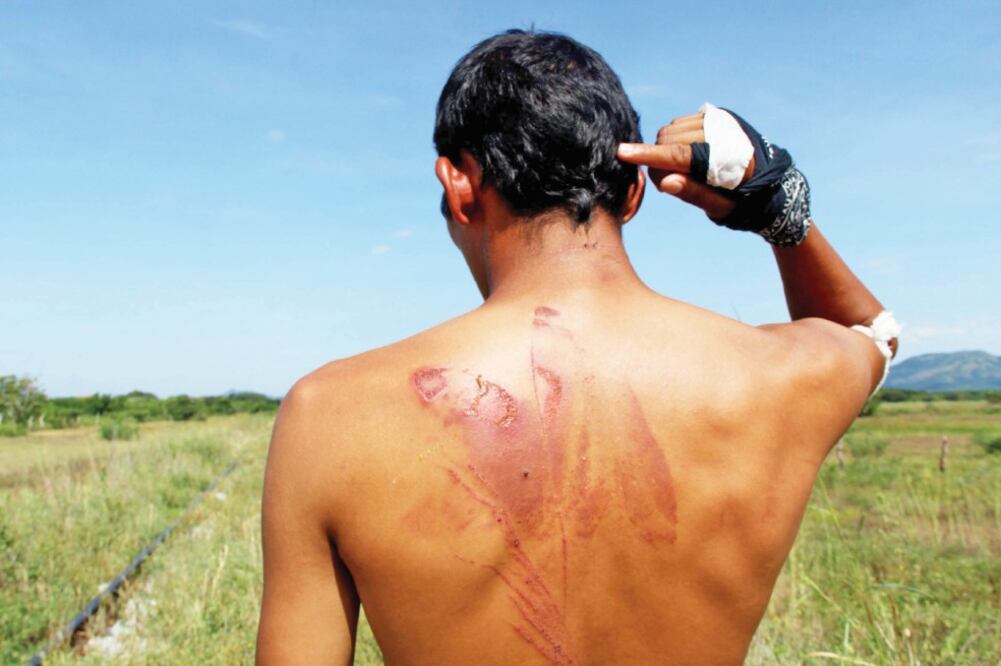 Nelson muestra las marcas que quedaron en su cuerpo tras ser agredido, junto con tres salvadoreños, por un grupo de encapuchados, quienes con violencia los despojaron de sus pertenencias (ROSELIA CHACA. EL UNIVERSAL)