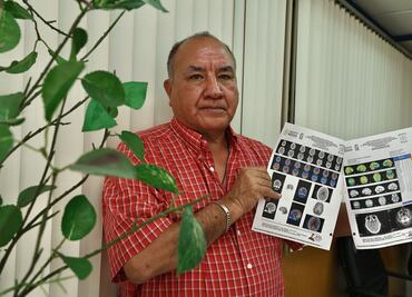 Covid persistente: la batalla de quienes siguen enfermos cinco años después