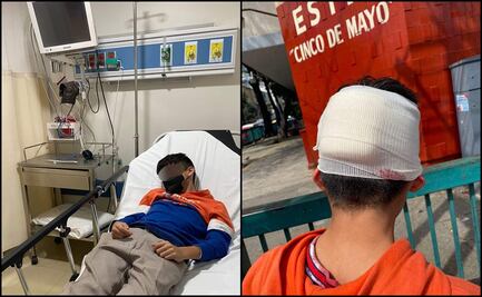 Denuncian agresión contra menor de edad en secundaria; le clavan un desarmador en la cabeza