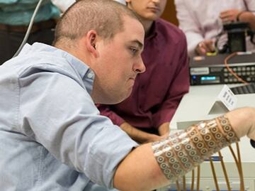 Joven tetrapléjico recupera movilidad en dedos gracias a un chip