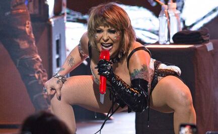 Alejandra Guzmán dice que "fue traumático" su accidente en el escenario: "Traía el fémur totalmente salido"