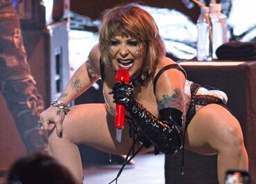 Alejandra Guzmán dice que "fue traumático" su accidente en el escenario: "Traía el fémur totalmente salido"