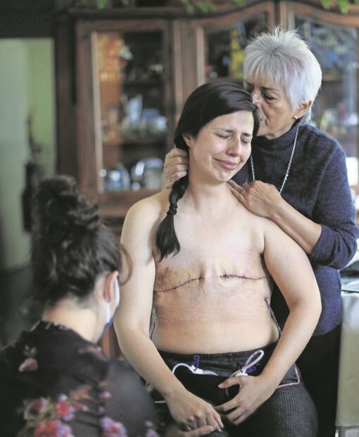 “Los senos no definen a las mujeres”, dice Sandra, sobreviviente de cáncer