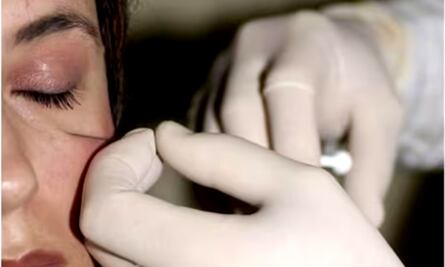 Piden en Senado y a Claudia Sheinbaum regular medicina estética para frenar escuelas “patito”