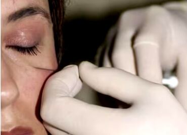 Piden en Senado y a Claudia Sheinbaum regular medicina estética para frenar escuelas “patito”