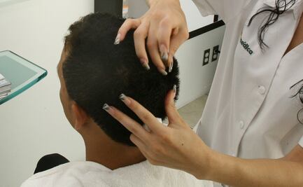 Micronutrientes evitan caída de cabello por Covid-19: expertos