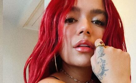 Karol G: la mala experiencia que pasó la Bichota en el quirófano