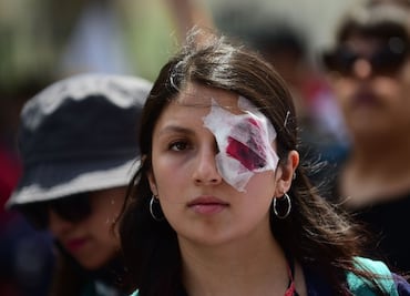 Miedo, ansiedad y culpa: el impacto psicológico de las protestas en Chile