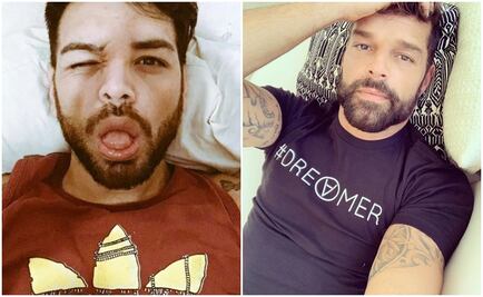 El hombre que se operó más de 20 veces para parecerse a Ricky Martin 