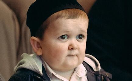 ¿Por qué arrestaron a Hasbulla, influencer con “cara de niño”, en Rusia?