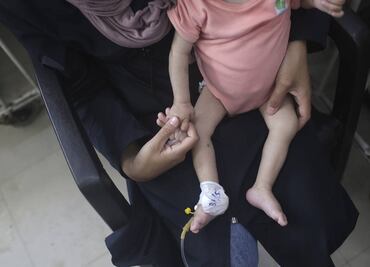 Hospital en Gaza reporta muerte de 21 niños por desnutrición y hambre; la mayoría durante las últimas 72 horas