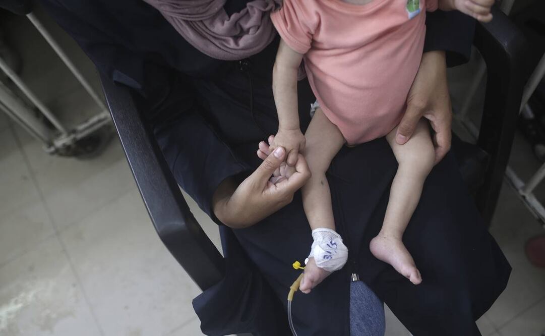 Amira Al-Jojo sostiene a su hijo de 10 meses, Yousef Al-Jojo, que sufre desnutrición en el Hospital de los Mártires de Al-Aqsa. Foto: AP