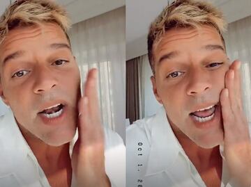 "No tengo nada que ocultar": Ricky Martin explica lo que le pasó en su rostro, tras polémica