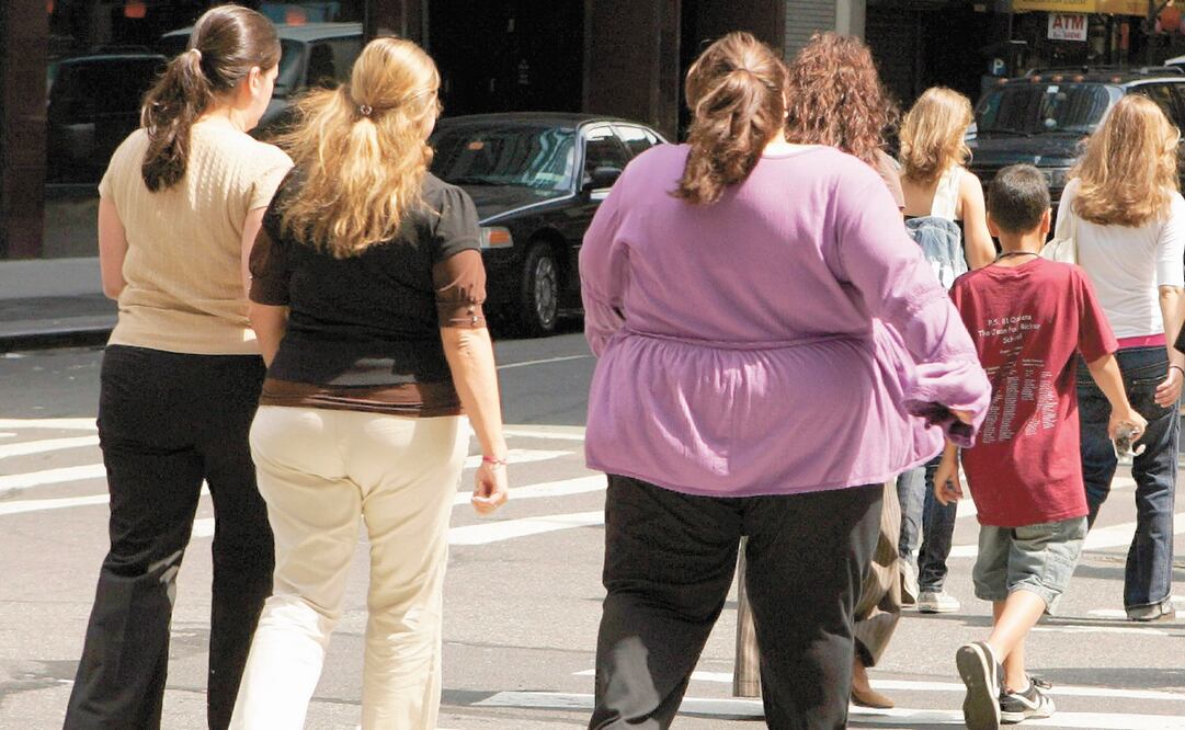 Uno de los efectos del sedentarismo es la obesidad, condición propicia para contagiarse de Covid-19. Foto: Archivo