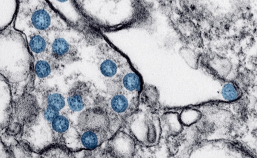 ¿Qué sabemos de la variante del Covid-19 hallada en la India que llegó a México?