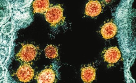 Mutaciones del Covid-19 podrían generar variante más peligrosa: expertos