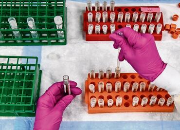 Mexico signs commitment to purchase WHO’s COVID-19 vaccines through COVAX