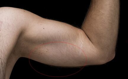 Trigonelina: el mejor aliado para combatir las alas de murciélago después de los 40