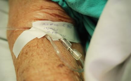 En México, hasta 4 mil 492 nuevos casos de cáncer de riñón por año