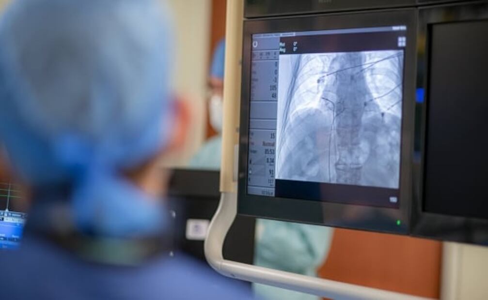 ¿Por qué es importante la prevención cardiometabólica y que cuides tu corazón?