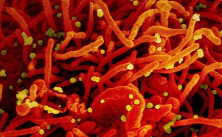 Autoanticuerpos provocan casos graves y duraderos de Covid-19: estudio