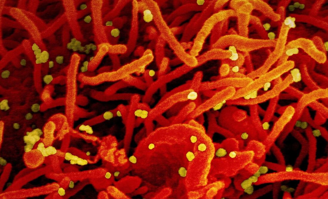 Foto: EFE/EPA/NIAID/NATIONAL INSTITUTES OF HEALTH