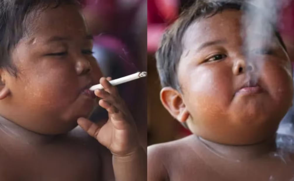 Al confiscarle los cigarrillos, el pequeño realizaba rabietas en las que se golpeaba la cabeza Foto: EFE
